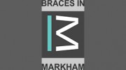 Braces In Markham
