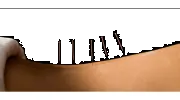 Acupuncture Turning Point