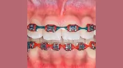 GD Orthodontics