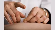 Dr Jason Wang-Surrey Acupuncture & Chinese Clinic