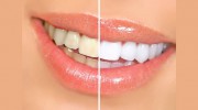 Colborne Family Dental